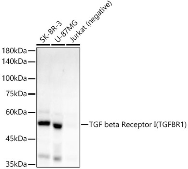 Western blot analysis of extracts of various cell lines, using TGF beta Receptor I (TGFBR1) antibody (CAB22151) at1:2000 dilution. Secondary antibody: HRP Goat Anti-Rabbit IgG (H+L) at 1:10000 dilution. Lysates/proteins: 25μg per lane. Blocking buffer: 3% nonfat dry milk in TBST.