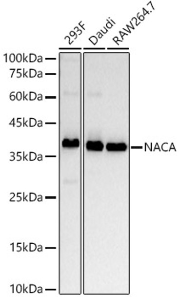 Western blot analysis of various lysates, using NACA antibody (CAB22165) at1:20000 dilution. Secondary antibody: HRP Goat Anti-Rabbit IgG (H+L) at 1:10000 dilution. Lysates/proteins: 25μg per lane. Blocking buffer: 3% nonfat dry milk in TBST.