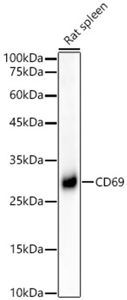 Western blot analysis of Rat spleen, using CD69 antibody (CAB22171) at1:4000 dilution. Secondary antibody: HRP Goat Anti-Rabbit IgG (H+L) at 1:10000 dilution. Lysates/proteins: 25μg per lane. Blocking buffer: 3% nonfat dry milk in TBST.