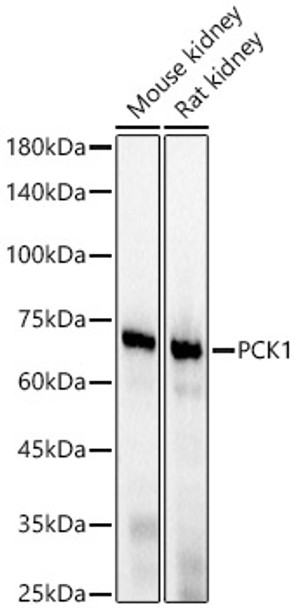 Western blot analysis of various lysates, using PCK1 antibody (CAB22172) at1:2000 dilution. Secondary antibody: HRP Goat Anti-Rabbit IgG (H+L) at 1:10000 dilution. Lysates/proteins: 25μg per lane. Blocking buffer: 3% nonfat dry milk in TBST.