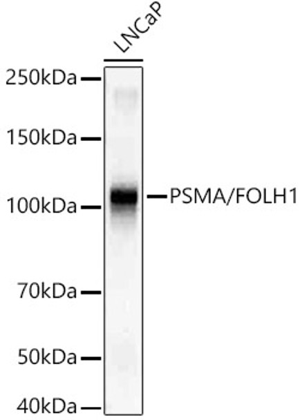 Western blot analysis of LNCaP, using PSMA/FOLH1 antibody (CAB22212) at1:20000 dilution. Secondary antibody: HRP Goat Anti-Rabbit IgG (H+L) at 1:2000000 dilution. Lysates/proteins: 25μg per lane. Blocking buffer: 3% nonfat dry milk in TBST.