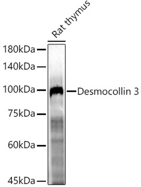 Western blot analysis of Rat thymus, using Desmocollin3 antibody (CAB22232) at 1:500 dilution. Secondary antibody: HRP Goat Anti-Rabbit IgG (H+L) at 1:10000 dilution. Lysates/proteins: 25μg per lane. Blocking buffer: 3% nonfat dry milk in TBST.