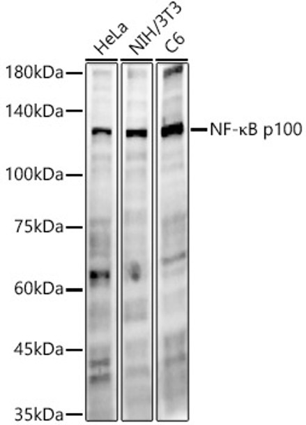Western blot analysis of various lysates, using NF-κB2 antibody (CAB22279) at 1:700 dilution. Secondary antibody: HRP Goat Anti-Rabbit IgG (H+L) at 1:10000 dilution. Lysates/proteins: 25μg per lane. Blocking buffer: 3% nonfat dry milk in TBST.