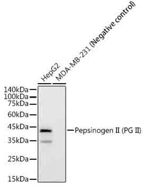 Western blot analysis of extracts of various cell lines, using Pepsinogen II (PG II) Rabbit mAb (CAB22281) at1:2000 dilution. Secondary antibody: HRP Goat Anti-Rabbit IgG (H+L) at1:10000 dilution. Lysates/proteins: 25μg per lane. Blocking buffer: 3% nonfat dry milk in TBST.