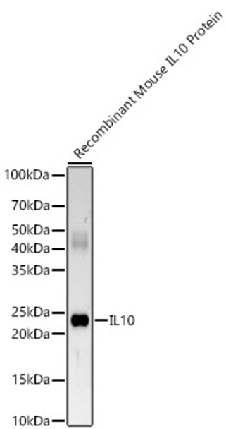 Western blot analysis of various lysates, using IL10 antibody (CAB22288) at1:2000 dilution. Secondary antibody: HRP Goat Anti-Rabbit IgG (H+L) at 1:10000 dilution. Lysates/proteins: 25μg per lane. Blocking buffer: 3% nonfat dry milk in TBST.