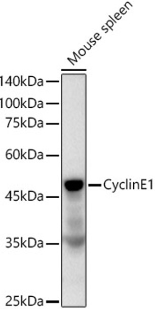 Western blot analysis of Mouse spleen, using CyclinE1 antibody (CAB22360) at 1:1000 dilution. Secondary antibody: HRP Goat Anti-Rabbit IgG (H+L) at 1:10000 dilution. Lysates/proteins: 25μg per lane. Blocking buffer: 3% nonfat dry milk in TBST.