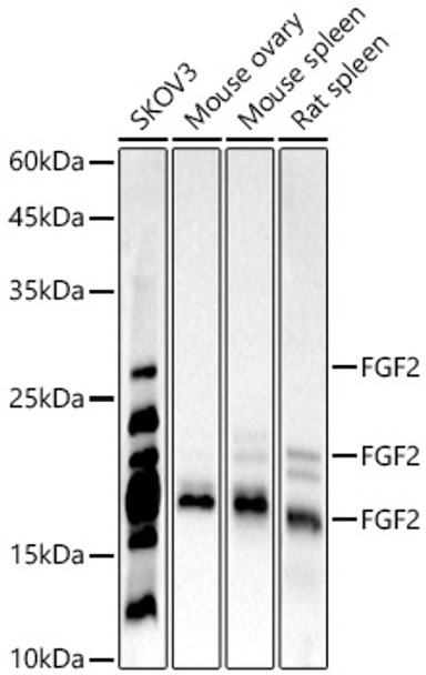 Western blot analysis of various lysates, using FGF2 antibody (CAB22448) at 1:1000 dilution. Secondary antibody: HRP Goat Anti-Rabbit IgG (H+L) at 1:10000 dilution. Lysates/proteins: 25μg per lane. Blocking buffer: 3% nonfat dry milk in TBST.