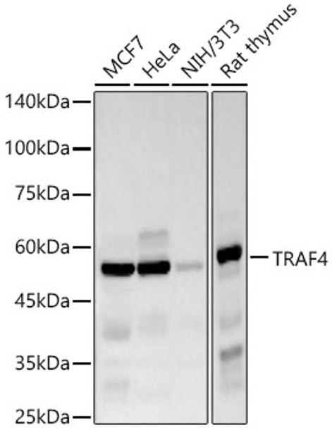 Western blot analysis of various lysates, using TRAF4 antibody (CAB22472) at 1:2000 dilution. Secondary antibody: HRP Goat Anti-Rabbit IgG (H+L) at 1:10000 dilution. Lysates/proteins: 25μg per lane. Blocking buffer: 3% nonfat dry milk in TBST.