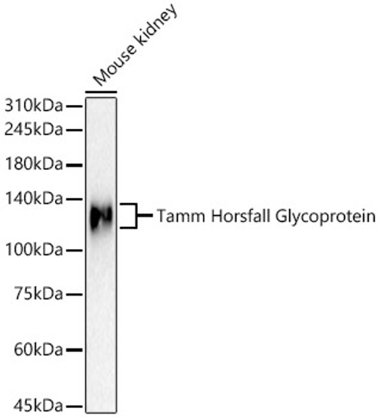 Western blot analysis of Mouse kidney, using Tamm Horsfall Glycoprotein antibody (CAB22544) at 1:400 dilution. Secondary antibody: HRP Goat Anti-Rabbit IgG (H+L) at 1:10000 dilution. Lysates/proteins: 25μg per lane. Blocking buffer: 3% nonfat dry milk in TBST.