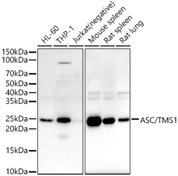 Western blot analysis of various lysates, using ASC/TMS1 antibody (CAB22555) at 1:600 dilution. Secondary antibody: HRP Goat Anti-Rabbit IgG (H+L) at 1:10000 dilution. Lysates/proteins: 25μg per lane. Blocking buffer: 3% nonfat dry milk in TBST.