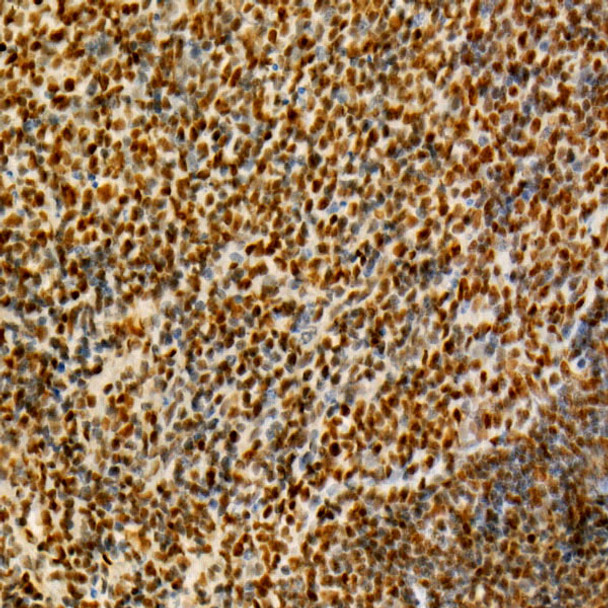 Immunohistochemistry analysis of paraffin-embedded mouse spleen using RB Rabbit mAb (CAB22663) at dilution of 1:200 (40x lens). Perform high pressure antigen retrieval with 10 mM citrate buffer pH 6. 0 before commencing with IHC staining protocol.