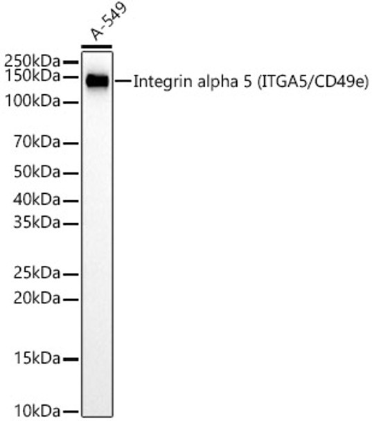 Western blot analysis of extracts from A-549 cells, using Integrin alpha 5 (ITGA5/CD49e) antibody (CAB22706) at 1:1000 dilution. Secondary antibody: HRP Goat Anti-Rabbit IgG (H+L) at 1:10000 dilution. Lysates/proteins: 25μg per lane. Blocking buffer: 3% nonfat dry milk in TBST.