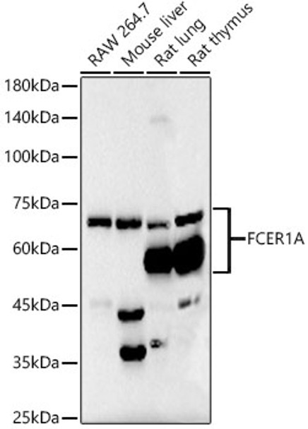 Western blot analysis of various lysates, using FceR1 alpha antibody (CAB22729) at 1:6000 dilution. Secondary antibody: HRP Goat Anti-Rabbit IgG (H+L) at 1:10000 dilution. Lysates/proteins: 25μg per lane. Blocking buffer: 3% nonfat dry milk in TBST.