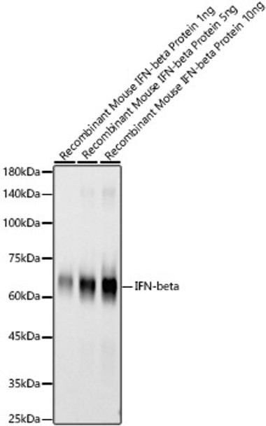 Western blot analysis of Recombinant Mouse IFN-beta Protein (RP01076，C-hFc&His taged), using IFN-beta antibody (CAB22740) at 1:6000 dilution. Secondary antibody: HRP Goat Anti-Rabbit IgG (H+L) at 1:10000 dilution. Lysates/proteins: 25μg per lane. Blocking buffer: 3% nonfat dry milk in TBST.