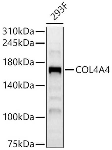 Western blot analysis of 293F, using COL4A4 antibody (CAB22870) at 1:800 dilution. Secondary antibody: HRP Goat Anti-Rabbit IgG (H+L) at 1:10000 dilution. Lysates/proteins: 25μg per lane. Blocking buffer: 3% nonfat dry milk in TBST.