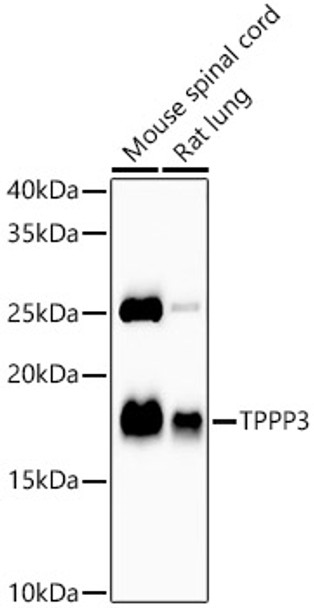 Western blot analysis of various lysates, using TPPP3 antibody (CAB22991) at 1:1000 dilution. Secondary antibody: HRP Goat Anti-Rabbit IgG (H+L) at 1:10000 dilution. Lysates/proteins: 25μg per lane. Blocking buffer: 3% nonfat dry milk in TBST.