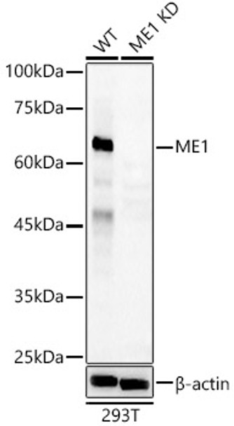 Western blot analysis of extracts from wild type(WT) and ME1 knockdown (KD) MCF7(KD) cells, using ME1 antibody (CAB23068) at 1:400 dilution. Secondary antibody: HRP Goat Anti-Rabbit IgG (H+L) at 1:10000 dilution. Lysates/proteins: 25μg per lane. Blocking buffer: 3% nonfat dry milk in TBST.