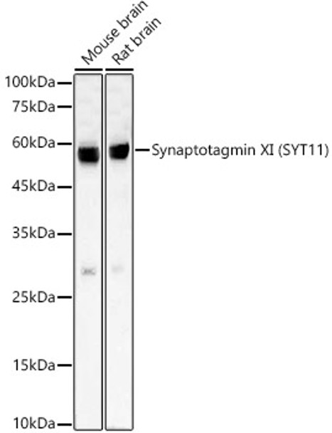 Western blot analysis of various lysates, using Synaptotagmin XI (SYT11) antibody (CAB23089) at 1:2000 dilution. Secondary antibody: HRP Goat Anti-Rabbit IgG (H+L) at 1:10000 dilution. Lysates/proteins: 25μg per lane. Blocking buffer: 3% nonfat dry milk in TBST.