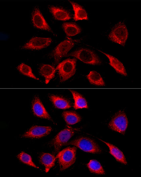 Immunofluorescence analysis of HeLa using GALC Rabbit mAb (CAB23228) at dilution of 1:100 (40x lens). Blue: DAPI for nuclear staining.