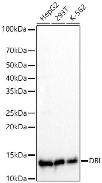 Western blot analysis of various lysates, using DBI Rabbit mAb (CAB23242) at 1:1000 dilution. Secondary antibody: HRP Goat Anti-Rabbit IgG (H+L) at 1:10000 dilution. Lysates/proteins: 25μg per lane. Blocking buffer: 3% nonfat dry milk in TBST.