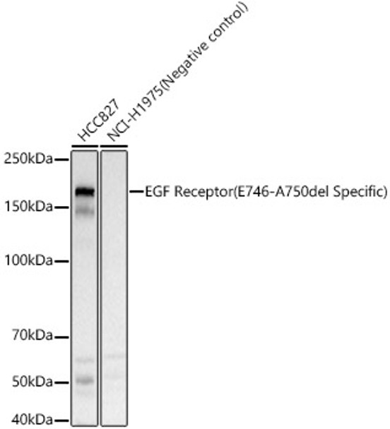 Western blot analysis of various lysates, using EGF Receptor (E746-A750del Specific) Rabbit pAb (CAB23256) at 1:400 dilution. Secondary antibody: HRP Goat Anti-Rabbit IgG (H+L) at 1:10000 dilution. Lysates/proteins: 25μg per lane. Blocking buffer: 3% nonfat dry milk in TBST.