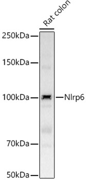 Western blot analysis of Rat colon, using Nlrp6 Rabbit pAb (CAB23267) at 1:2000 dilution. Secondary antibody: HRP Goat Anti-Rabbit IgG (H+L) at 1:10000 dilution. Lysates/proteins: 25μg per lane. Blocking buffer: 3% nonfat dry milk in TBST.