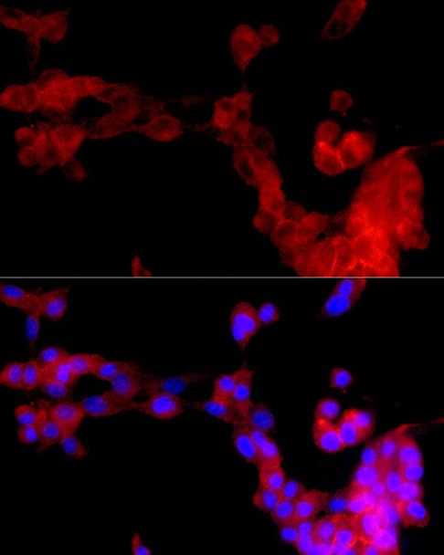 Immunofluorescence analysis of U-87MG cells using uPAR/U-PAR Rabbit mAb (CAB23293) at dilution of 1:300 (40x lens). Blue: DAPI for nuclear staining.