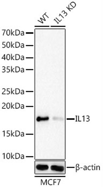 Western blot analysis of extracts from wild type(WT) and IL13 knockdown (KD) MCF7cells, using IL13 Rabbit mAb (CAB23415) at 1:1000 dilution. Secondary antibody: HRP Goat Anti-Rabbit IgG (H+L) at 1:10000 dilution. Lysates/proteins: 25μg per lane. Blocking buffer: 3% nonfat dry milk in TBST.