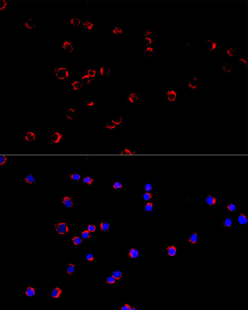 Immunofluorescence analysis of Daudi using KCNN3/SK3 Rabbit mAb (CAB23418) at dilution of 1:100 (40x lens). Blue: DAPI for nuclear staining.