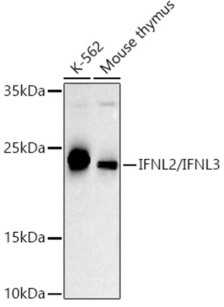 Western blot analysis of extracts of various cell lines, using IFNL2/IFNL3 antibody (CAB23437) at 1:500 dilution. Secondary antibody: HRP Goat Anti-Rabbit IgG (H+L) at 1:10000 dilution. Lysates/proteins: 25μg per lane. Blocking buffer: 3% nonfat dry milk in TBST.