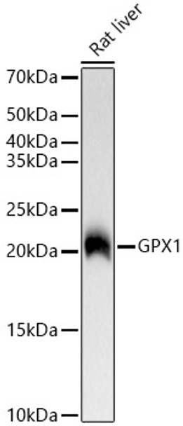 Western blot analysis of Rat liver, using GPX1 antibody (CAB23519) at 1:2000 dilution. Secondary antibody: HRP Goat Anti-Rabbit IgG (H+L) at 1:10000 dilution. Lysates/proteins: 25μg per lane. Blocking buffer: 3% nonfat dry milk in TBST.