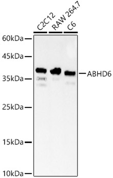 Western blot analysis of various lysates, using ABHD6 Rabbit pAb (CAB23526) at 1:500 dilution. Secondary antibody: HRP Goat Anti-Rabbit IgG (H+L) at 1:10000 dilution. Lysates/proteins: 25ug per lane. Blocking buffer: 3% nonfat dry milk in TBST.