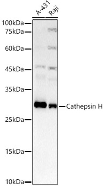 Western blot analysis of various lysates, using Cathepsin H Rabbit mAb (CAB23573) at 1:1000 dilution. Secondary antibody: HRP Goat Anti-Rabbit IgG (H+L) at 1:10000 dilution. Lysates/proteins: 25μg per lane. Blocking buffer: 3% nonfat dry milk in TBST.