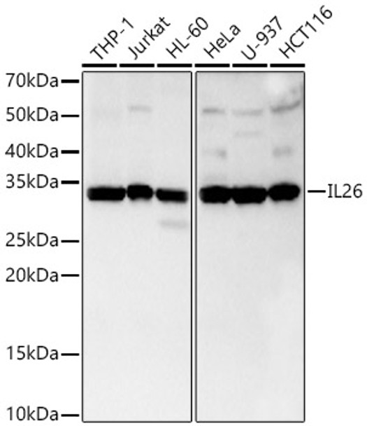 Western blot analysis of various lysates, using IL26 Rabbit mAb (CAB23576) at 1:1000 dilution. Secondary antibody: HRP Goat Anti-Rabbit IgG (H+L) at 1:10000 dilution. Lysates/proteins: 25μg per lane. Blocking buffer: 3% nonfat dry milk in TBST.