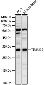 Western blot analysis of various lysates, using TIMM29 Rabbit pAb (CAB23671) at 1:500 dilution. Secondary antibody: HRP Goat Anti-Rabbit IgG (H+L) at 1:10000 dilution. Lysates/proteins: 25ug per lane. Blocking buffer: 3% nonfat dry milk in TBST.