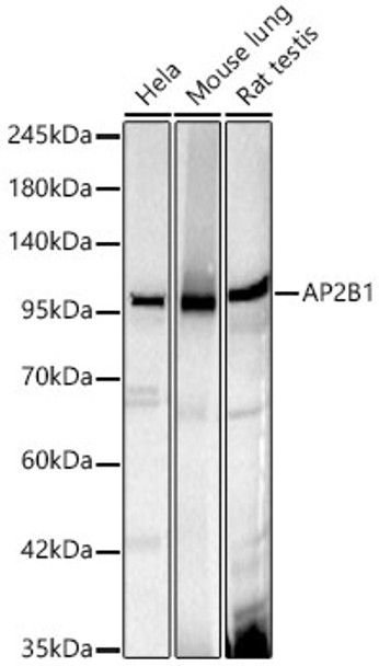 Western blot analysis of various lysates, using AP2B1 Rabbit mAb (CAB23784) at 1:1000 dilution. Secondary antibody: HRP Goat Anti-Rabbit IgG (H+L) at 1:10000 dilution. Lysates/proteins: 25μg per lane. Blocking buffer: 3% nonfat dry milk in TBST.