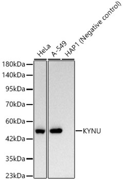 Western blot analysis of various lysates, using KYNU Rabbit mAb (CAB23962) at 1:1000 dilution. Secondary antibody: HRP Goat Anti-Rabbit IgG (H+L) at 1:10000 dilution. Lysates/proteins: 25ug per lane. Blocking buffer: 3% nonfat dry milk in TBST.