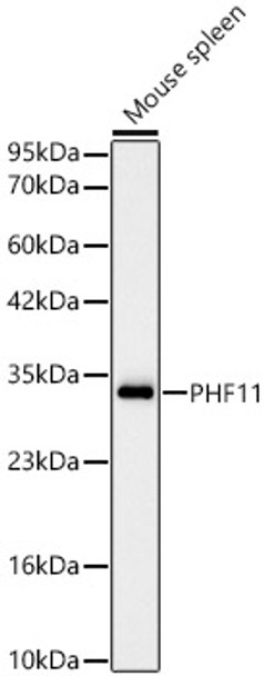 Western blot analysis of Mouse spleen, using PHF11 Rabbit mAb (CAB23994) at 1:2000 dilution. Secondary antibody: HRP Goat Anti-Rabbit IgG (H+L) at 1:10000 dilution. Lysates/proteins: 25ug per lane. Blocking buffer: 3% nonfat dry milk in TBST.