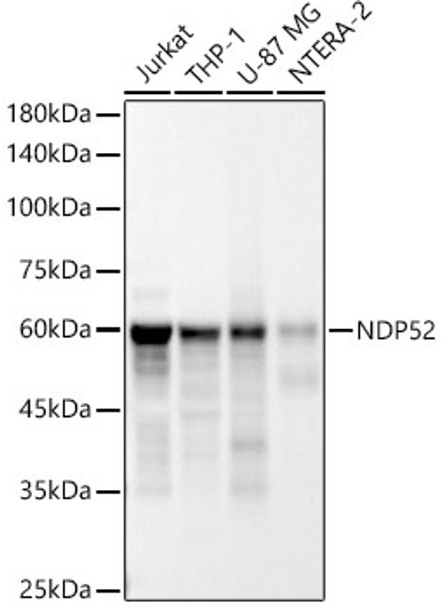 Western blot analysis of various lysates, using NDP52 Rabbit mAb (CAB24021) at 1:5000 dilution. Secondary antibody: HRP Goat Anti-Rabbit IgG (H+L) at 1:10000 dilution. Lysates/proteins: 25ug per lane. Blocking buffer: 3% nonfat dry milk in TBST.
