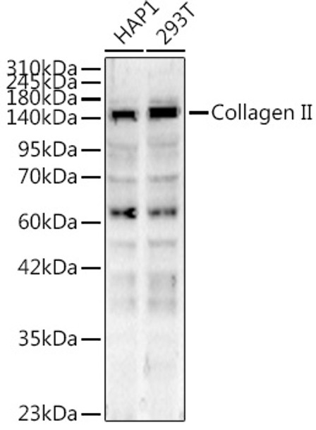 Western blot analysis of extracts of various cell lines, using Collagen II Rabbit pAb (CAB24334) at 1:400 dilution. Secondary antibody: HRP Goat Anti-Rabbit IgG (H+L) at 1:10000 dilution. Lysates/proteins: 25ug per lane. Blocking buffer: 3% nonfat dry milk in TBST.