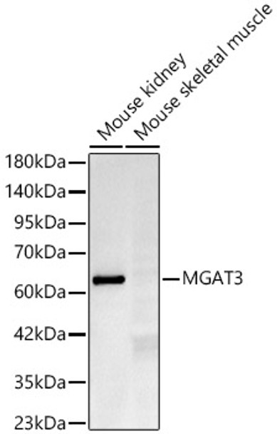 Western blot analysis of various lysates, using MGAT3 Rabbit mAb (CAB24347) at 1:1000 dilution. Secondary antibody: HRP Goat Anti-Rabbit IgG (H+L) at 1:10000 dilution. Lysates/proteins: 25ug per lane. Blocking buffer: 3% nonfat dry milk in TBST.