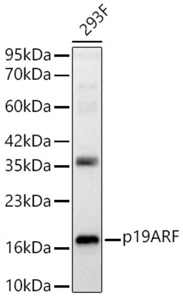 Western blot analysis of 293F, using p19ARF Rabbit pAb (CAB24462) at 1:1000 dilution. Secondary antibody: HRP Goat Anti-Rabbit IgG (H+L) at 1:10000 dilution. Lysates/proteins: 25ug per lane. Blocking buffer: 3% nonfat dry milk in TBST.