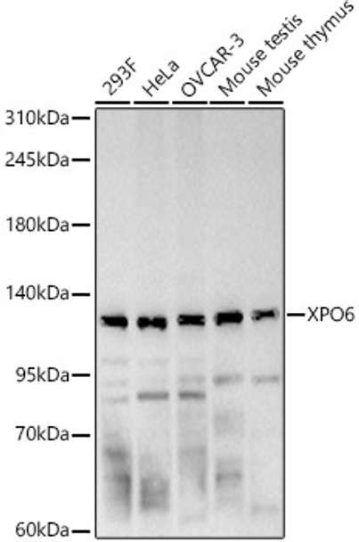 Western blot analysis of various lysates, using XPO6 Rabbit pAb (CAB24463) at 1:1000 dilution. Secondary antibody: HRP Goat Anti-Rabbit IgG (H+L) at 1:10000 dilution. Lysates/proteins: 25ug per lane. Blocking buffer: 3% nonfat dry milk in TBST.