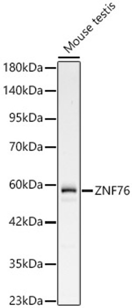 Western blot analysis of Mouse testis, using ZNF76 Rabbit pAb (CAB24491) at 1:2000 dilution. Secondary antibody: HRP Goat Anti-Rabbit IgG (H+L) at 1:10000 dilution. Lysates/proteins: 25ug per lane. Blocking buffer: 3% nonfat dry milk in TBST.