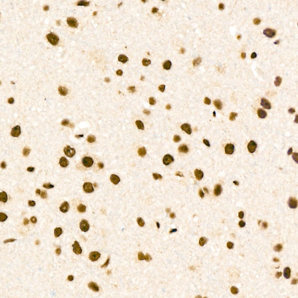 Immunohistochemistry analysis of ZNF324 in paraffin-embedded rat brain tissue using ZNF324 Rabbit pAb (CAB24498) at a dilution of  1:100 (40x lens).  High pressure antigen retrieval was performed with 0. 01 M citrate buffer (pH 6. 0) prior to IHC staining.