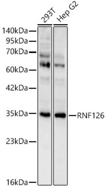 Western blot analysis of various lysates, using RNF126 Rabbit pAb (CAB24515) at 1:2000 dilution. Secondary antibody: HRP Goat Anti-Rabbit IgG (H+L) at 1:10000 dilution. Lysates/proteins: 25ug per lane. Blocking buffer: 3% nonfat dry milk in TBST.