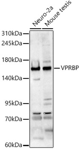 Western blot analysis of various lysates, using VPRBP Rabbit pAb (CAB24518) at 1:1000 dilution. Secondary antibody: HRP Goat Anti-Rabbit IgG (H+L) at 1:10000 dilution. Lysates/proteins: 25ug per lane. Blocking buffer: 3% nonfat dry milk in TBST.