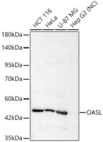 Western blot analysis of various lysates, using OASL Rabbit pAb (CAB24529) at 1:1000 dilution. Secondary antibody: HRP Goat Anti-Rabbit IgG (H+L) at 1:10000 dilution. Lysates/proteins: 25ug per lane. Blocking buffer: 3% nonfat dry milk in TBST.