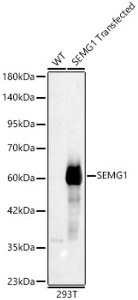 Western blot analysis of lysates from wild type (WT) and 293T cells transfected with SEMG1, using SEMG1 Rabbit pAb (CAB24532) at 1:400 dilution. Secondary antibody: HRP Goat Anti-Mouse IgG (H+L) (AS003) at 1:10000 dilution. Lysates/proteins: 25ug per lane. Blocking buffer: 3% nonfat dry milk in TBST.
