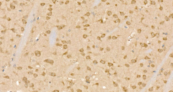 Immunohistochemistry analysis of paraffin-embedded mouse brain using CLPB Rabbit pAb (CAB24533) at dilution of 1:200 (40x lens). Perform high pressure antigen retrieval with 10 mM citrate buffer pH 6. 0 before commencing with IHC staining protocol.